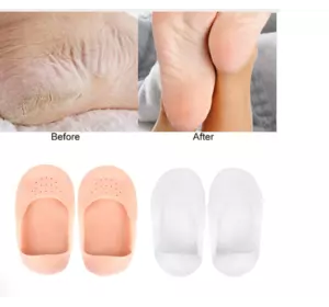 Силиконовые носки увлажняющие носочки против трения стопы ANTI-CRACK SILICONE SOCKS. Бежевый
